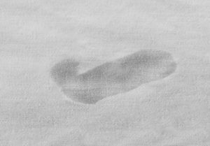 Example of chemical damage on a Poly-Cotton Blended Sheet